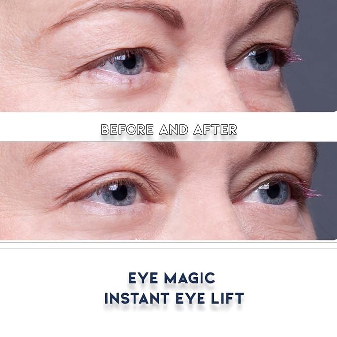 Premium Eyelid Lift (L/XL Kit + Gel) Made in the USA. Lifts and Defines Droopy, Sagging or Hooded Eyes Safe for Daily Use