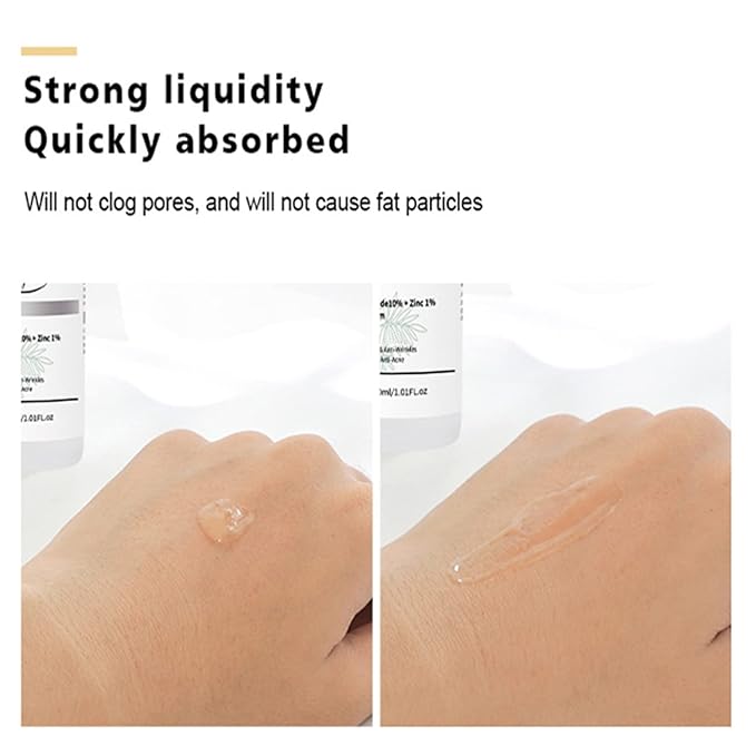 AICHUN BEAUTY Face Serum Eye Essence Anti-Wrinkles Anti-Acne Oil-Control Anti-Freckle Refreshing Moisturizing Purifying Shrink Pores 30ml 1.01FL.oz (Niacinamide10% + Zinc 1% Face Serum)