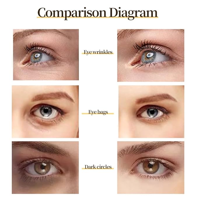 24 K Gold Eye Mask Puffy Eyes and Dark Circles Treatment Relieve Pressure and Reduce Wrinkles, Revitalize and Refresh Your Skin