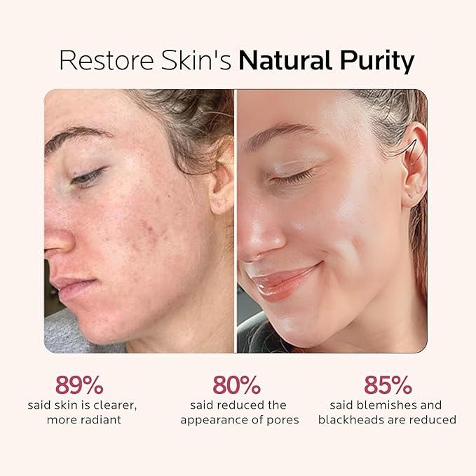 Facial Steamer Self-Care Gift Kit: Nano Ionic Face Steamer Deep Cleaning Unclogs Pores - Humidifier Hot Mist Spa Gifts for Women with 20 Skin Care Tools (Deep Cleansing Pore Refining)