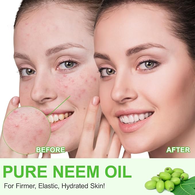 Neem Oil for Skin, Pure Natural Cold Pressing, Free of Hexane, Nourishes the Skin and Hair, Reduces Fine Lines, 2.02 Oz