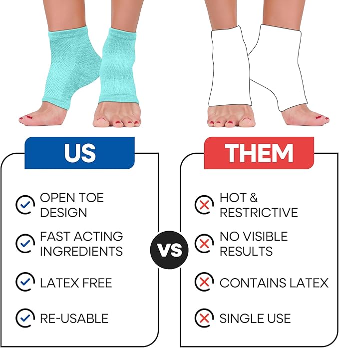 Moisturizing Socks for Women & Men | Cracked Heel Treatment with Aloe Vera | Moisturizer Foot Callus Remover | Aloe Socks for Cracked Heels & Dry Rough Feet, Lotion Infused Gel Heel Sleeves Fits Most
