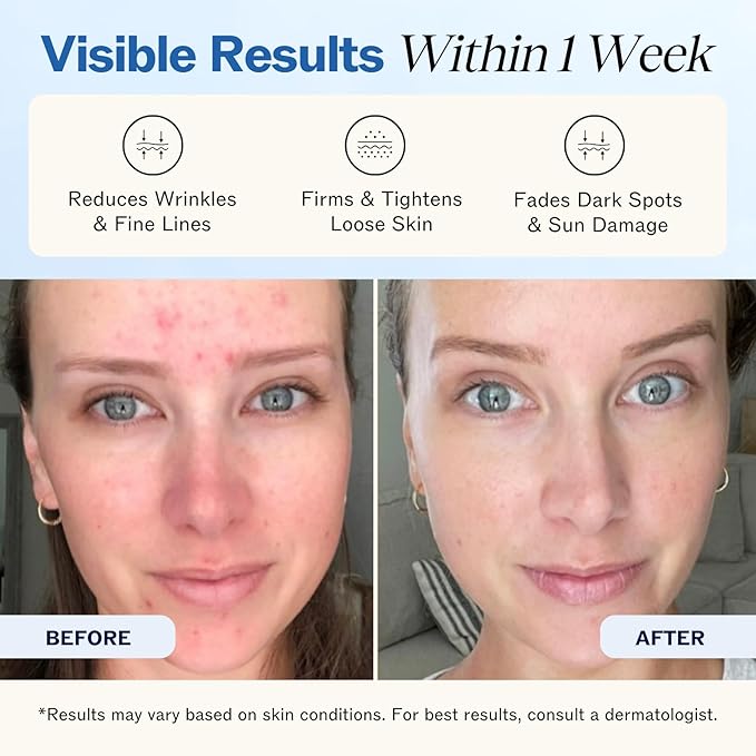 LilyAna Naturals Anti Aging Retinol Face Cream for Women – Wrinkle & Neck Cream for Firming, Retinol Moisturizer for Face with Hyaluronic Acid, Hydrating Night Cream for Fine Lines, Collagen Boost