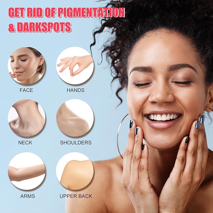 Dark Spot Corrector for Face and Body - Serum, Corrects Sun Spots, Freckles and Melasma - 1.7 Fl Oz