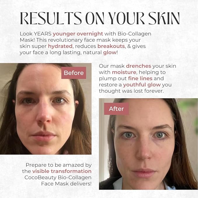 Bio Collagen Face Mask – Hydrating & Anti-Aging Korean Collagen Sheet Masks, Deep Hydration, Smooths Fine Lines, Overnight Face Mask for Radiant Skin (16 pcs)