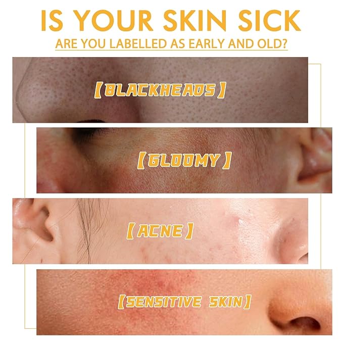 Glowtulip Honey Tearing Mask, Blackhead Control Honey Peel Mask for Face,Face Deep Cleasing & Moisturizing Mask,For All Skin (1PC)