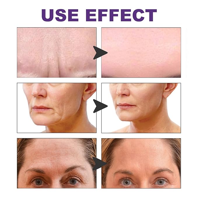 100 Pcs Face Tape for Wrinkles Lasting Face Lift Tape Overnight Invisible Silicone Face and Forehead Wrinkle Patches Neck Jowls Eye Cheek Chin Facial Lifting Instant Wrinkle Remover Strips