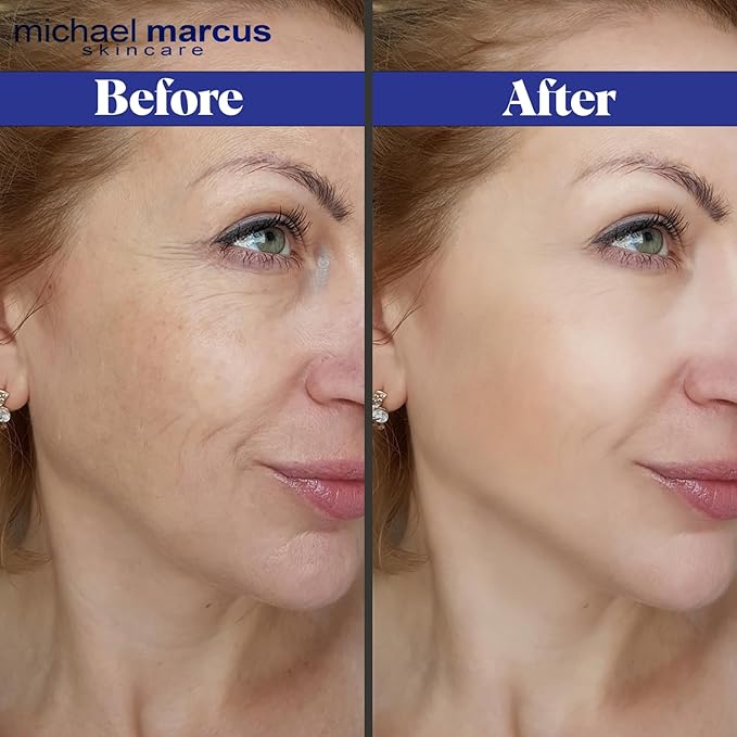 Micheal Marcus Hydromarine™ Eye Lift Serum - Reduces Wrinkles, Puffiness, Fine Line & Dark Circles - Under Eye Serum Improves Skin Elasticity, Skin texture & Brighten Complexion (30ml, 1 fl. oz)