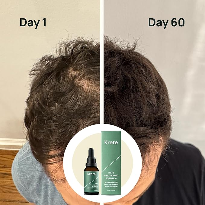 Krete Hair Thickening Formula – Supports Thicker-Looking Hair for Men – 1 fl oz