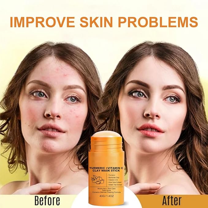 Turmeric Vitamin C Clay Mask Stick, Turmeric Clay Stick Mask with Vitamin C for Deep Clean Pore, Oil Control, Acne Blackhead Remover, Shrink Pores, Moisturize Skin and Balance Water and Oil