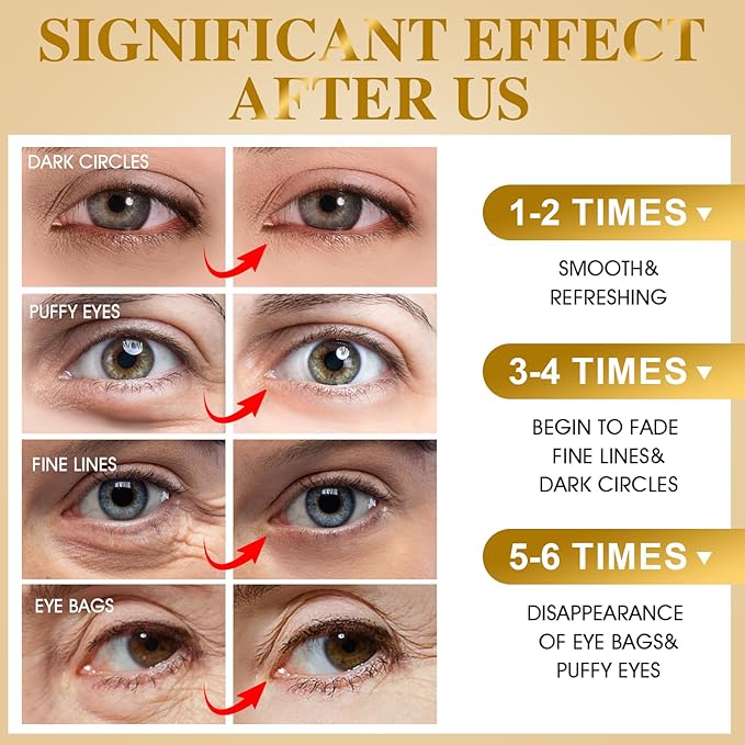 VESPRO 120 PCS 24K Gold Under Eye Patches for Dark Circles and Puffy Eyes, Eye Mask With Collagen and Hyaluronic Acid for Dark Circles, Puffiness and Wrinkles, Eye Skin Care for Women