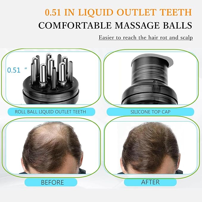 Gray Dual Application Scalp Hair Oil Comb - Hair Care Scalp Scrubber with Massage Balls Scalp Treatment Applicator Bottle for Essential Oil