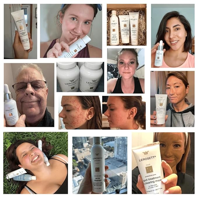 LEROSETT® Clear Skin Face Wash – Gentle Gel Cleanser with 60% Aloe-Rich Botanicals, 4% Glycolic Acid & Vit-E Microbeads – Fights Breakouts, Unclogs Pores, Balances Oil – Spa-Grade, Vegan – 6.7oz