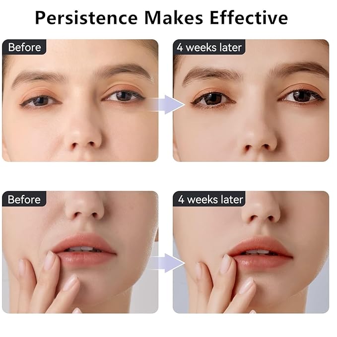 Eye Lift Wand, Eye Massager, Facial Massager for Dark Circles, Puffiness Under Eyes, Electrical Face & Neck Massage Pen for Fine Lines and Wrinkles