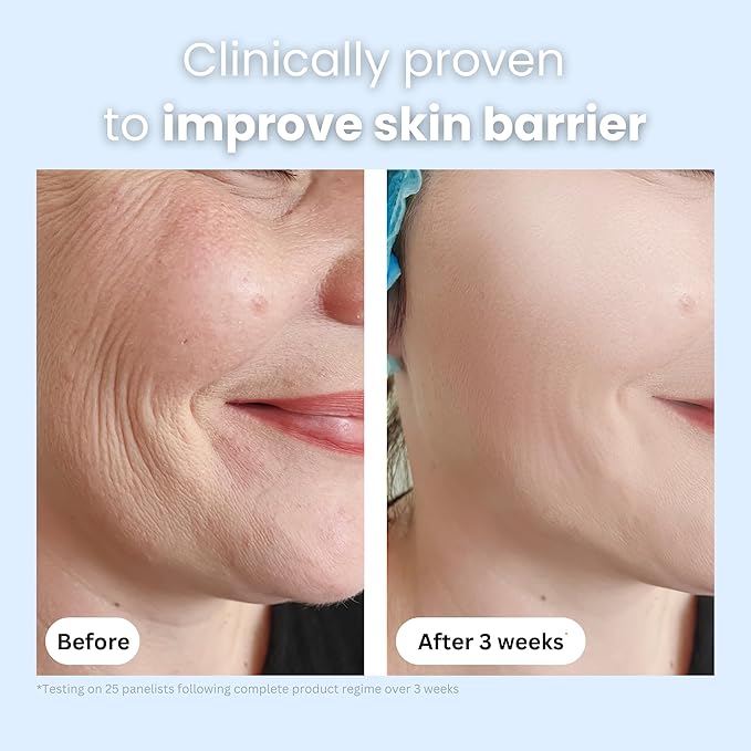 Save 5%: Organic Manuka Honey + Bee Venom Day and Night Cream Duo | Bee Venom Skin Treatment | Manuka Honey Skincare | 2oz/60ml