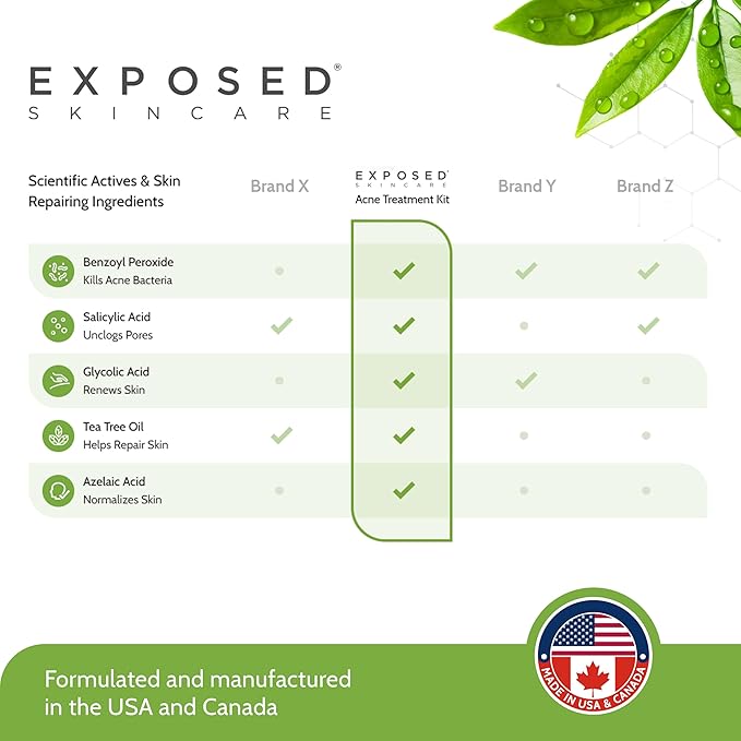 Exposed Skin Care Basic Acne Treatment Kit - Includes Salicylic Acid Face Wash, Clearing Tonic, Acne Treatment Serum with Benzoyl Peroxide, Clear Pore Serum - Acne Set Solution for All Skin Types