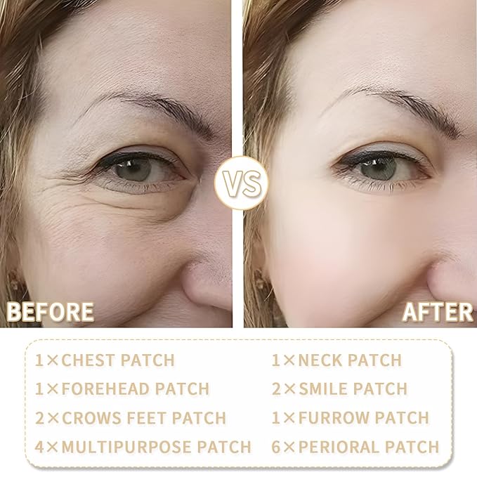 18 pcs Anti Wrinkle Patches, Reusable Forehead Wrinkle Patches Facial Anti Wrinkle Patches for Skin Lines Prevention, Silicone Face Patches for Forehead Wrinkles Treatment for Women