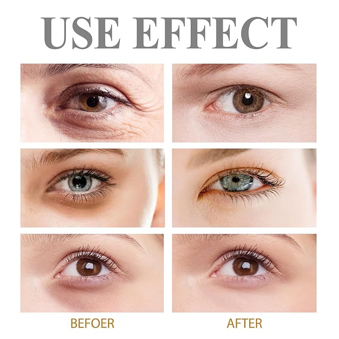 60-Second Eye Effects Age-Defying Tinted Firming Gel, Instant Firming Eye Cream, Eye Tightening Serum Instant, Instant Eye Bag Remover Puffiness, Anti-Wrinkle Eye Cream, Reduce Eye Skin Problems
