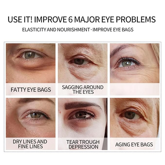 BLUE LOVE 1PC Astaxanthin Eye Serum - Reduces Dark Circles & Puffiness, Anti-Aging Formula Targets Wrinkles, Hydrating for Puffy Bags, Fast Absorbing & Moisturizing