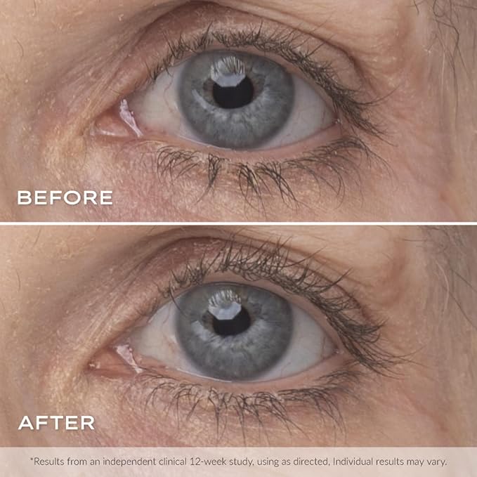 Younique's MOODSTRUCK ESTEEM Lash Serum | Eyelash Serum for Longer, Thicker and Stronger Lashes