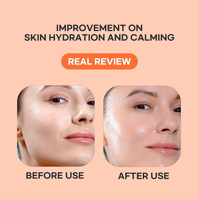 Epielle Vitamin C Serum Sheet Masks (5pk) | Korean Skincare | Facial Sheet Mask | Kbeauty, Mother's Day Gifts