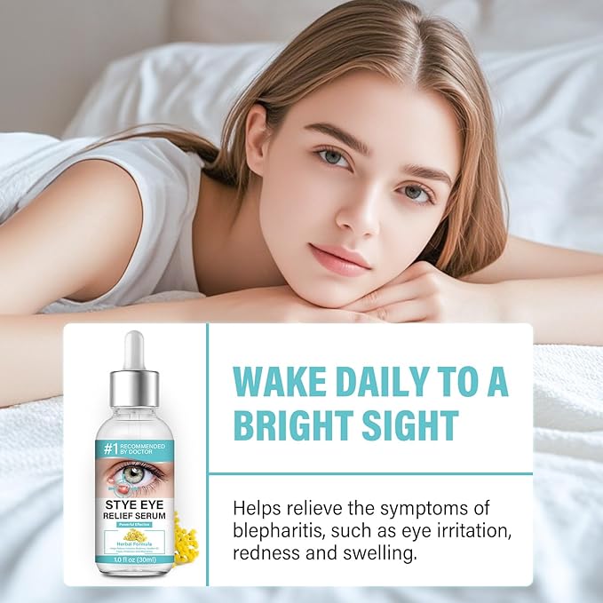 Stye Eye Treatment, Effective Stye Eye Relief Drop, for S_tyes Blepharitis and Chalazion Treatment, Regain Healthier Ey_e Skin