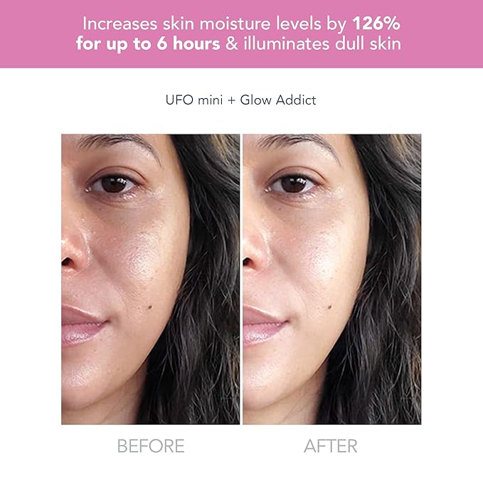 FOREO BEAR mini Microcurrent Facial Device + UFO mini 2 Face Mask Treatment + SERUM 1 fl. oz. + 6 UFO Power Activated Masks Skin Supremes Holiday Set