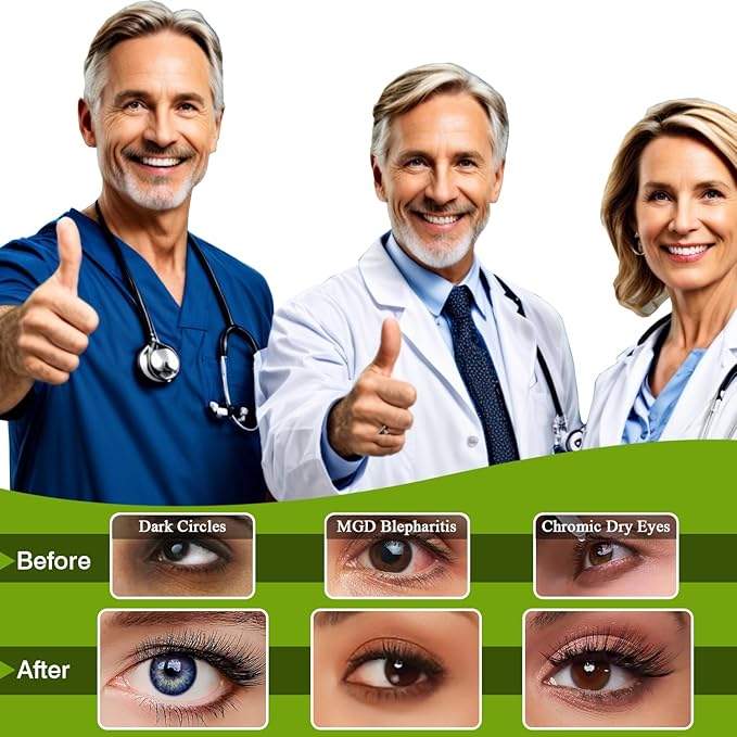 20 Packs Green Tea Scented Steam Eye Mask, Heated Eye Compress for Dry Eyes, Self Heating Eye Masks for Sleep, Spa, Travel Essentials, Relaxation Gift for Women & Men Stocking Stuffers