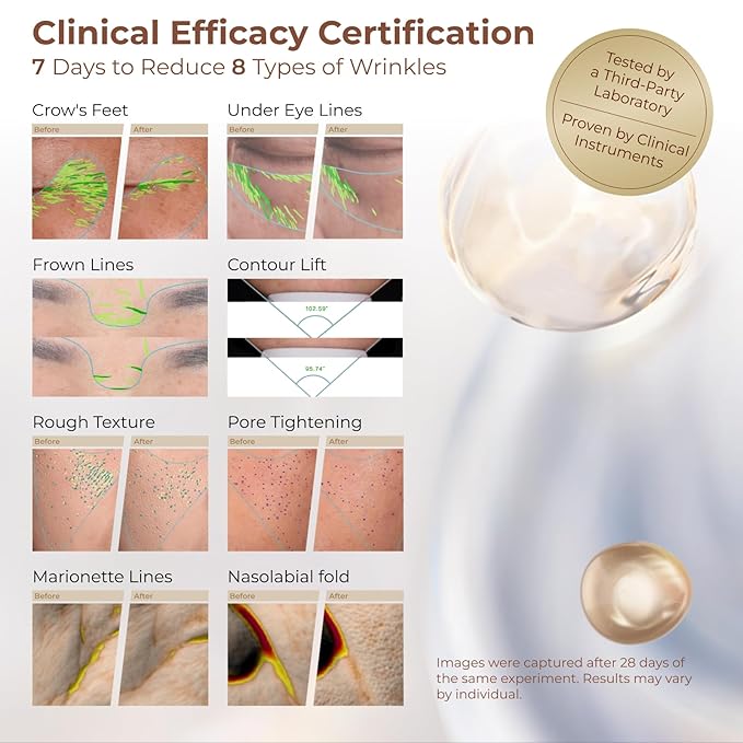 Extravagance Rejuvenation Collagen Cream (55g/1.94oz) - Collagen Anti Aging Face Cream Moisturizer for Boosts Skin Renewal and Collagen Replenishment