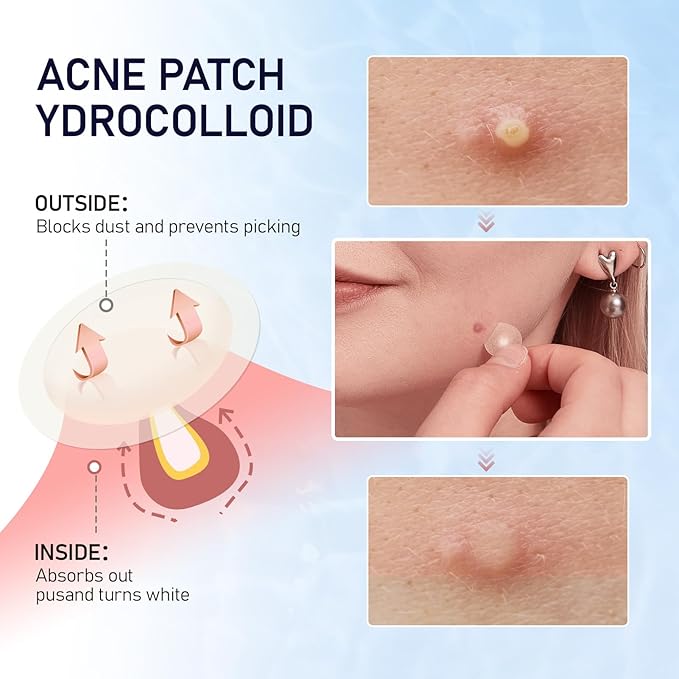 Pimple Patches for Face, 2 Sizes 192 Counts Acne Patches, Hydrocolloid Patches Zit Patches for Skin Care, Blemish Patches Invisible Acne Spot Treatment with Salicylic Acid, Tea Tree Oil