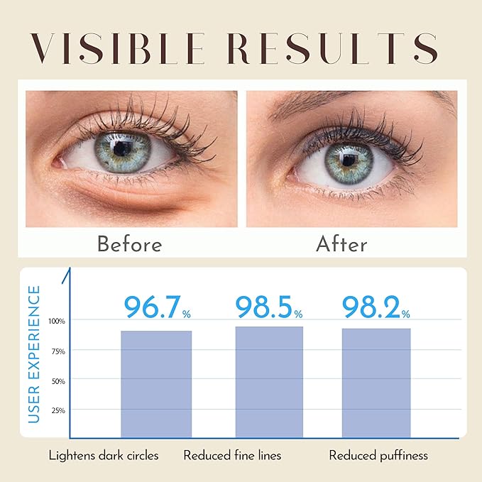 6% Caffeine + 1% Retinol Eye Cream for Dark Circles, Puffy Eyes & Bags | 360° Massage Ball for Fine Lines | Collagen & Centella | Anti-Aging Under Eye Care for Sensitive Skin Men & Women(0.7fl.oz)