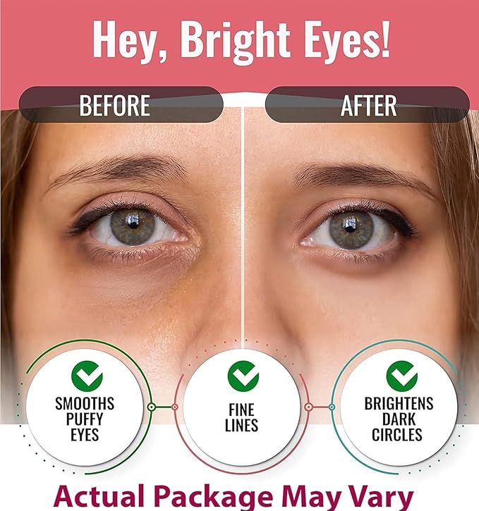 Look At Me Under Eye Patches (10 Pairs). Korean Skin Care Green Tea Hydrogel Eye Patch/Eye Pads. Dark Circle Remover and Collagen Eye Mask for Puffy Eyes. Gel Under Eye Brightener/Eye Depuffer