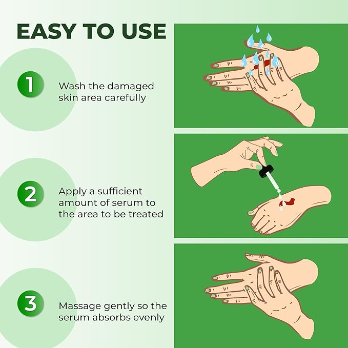 ABERA Alan Silver Serum - Clinically Proven to Soothe Irritated Skin and Improve The Appearance of Skin with Mild to Moderate Psoriasis (2 Boxes)