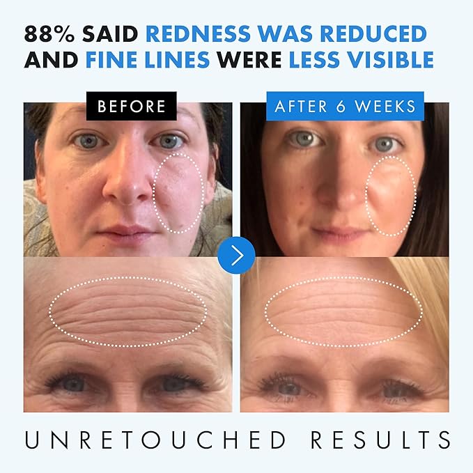 Hyaluronic Acid Serum for Face WITH 10 ANTIOXIDANTS +VITAMIN C & E +Aloe +WITCH HAZEL - 100% Organic & Vegan Moisturizing Anti-Aging Face Serum for Hydrating, Firming and Plumping Skin