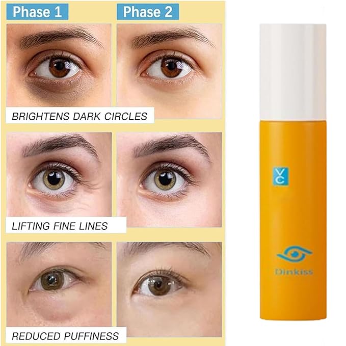 Dinkiss Lutein Eye Essence Oil, Vitamin C Lutein Eye Essence Oil, Improve Bags and Dark Circles, for Women Men (1, 1 pcs)
