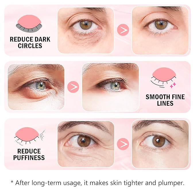 Under Eye Patches (30 Pairs) Rose Eye Mask for Puffy Eyes, Dark Circles, Eye Bag, Wrinkles - Undereye Bags, Birthday Gifts for Women - Vegan Cruelty-Free Self Care