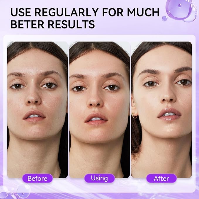 LENBENA Vitamin A Snail Mucin Serum, Self Care, Face Masks for Dry, Sensitive Skin, Not Tested on Animals (Vitamin A)