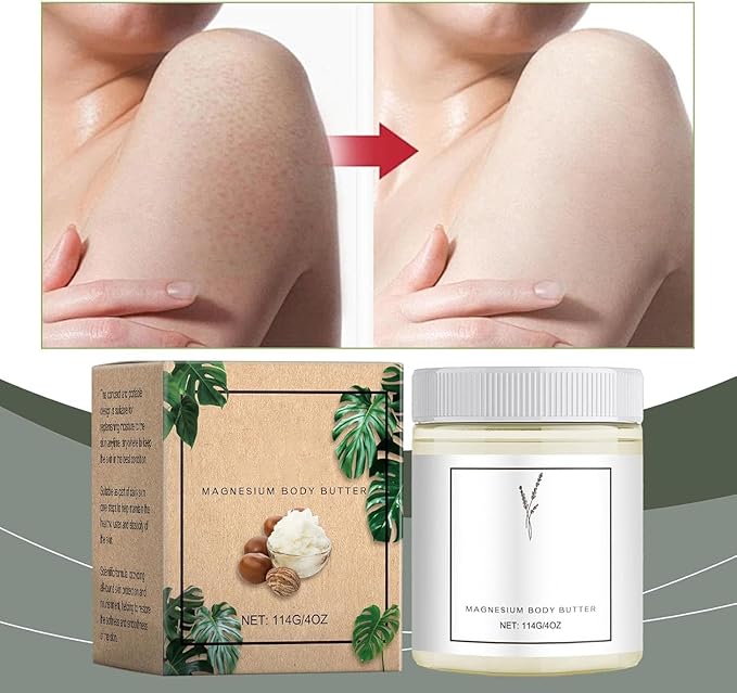 Neuropathy Mama Oasis Lotion,Neuropathy Magnesium Cream For Neuropathy Magnesium Body Butter Deeply Moisturizes Skin, Neuropathy Cream Magnesium,Keep Soft Smooth.