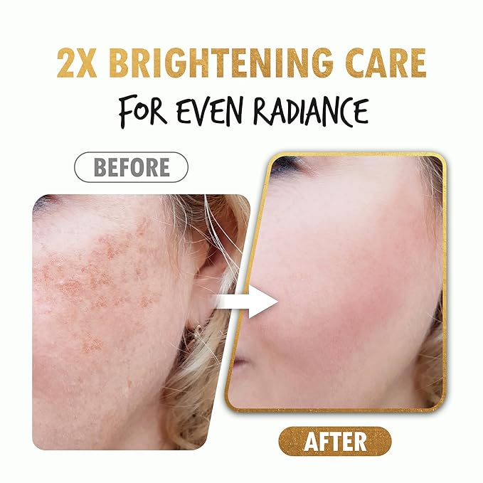 Brightening Shot Serum | Skin Brightening Serum for Face | Organic Face Moisturizer Hyperpigmentation Serum | Hydrating Face Serum for Glowing Skin | Face Brightening Serum (1.01 Fl. Oz)