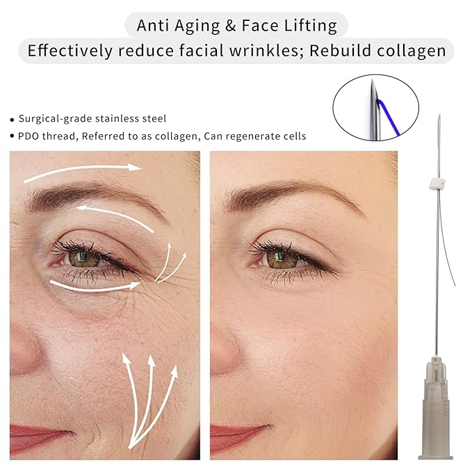 elves Pdo Mono Threads for Face Lift, Pdo Threads Lift 27G50mm, PDO Threads for Face Whole Body Lifting, PDO Smooth Threads Lifting 20Pcs