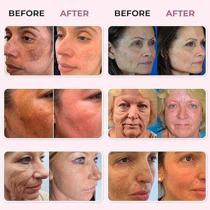 ABERA Saffron Serum For Melasma Treatment, Renewing for Face, Anti-Aging Treatment for Fine Lines & Wrinkles, High Potency Saffron Extract, Hydrating Serum, Dark Spot Remover (2 BOXES)