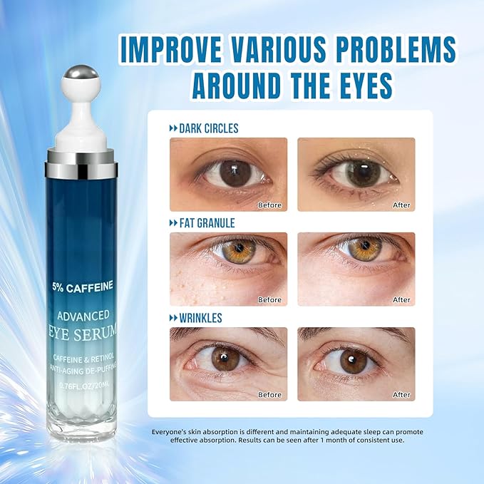 5% Caffeine Eye Cream & Under Eye Serum for Dark Circles and Wrinkles, Under Eye Bags Treatment, Anti-Aging Caffeine Eye Serum with Hyaluronic Acid and Niacinamide, 360° Eye Roller Massage(20ML)