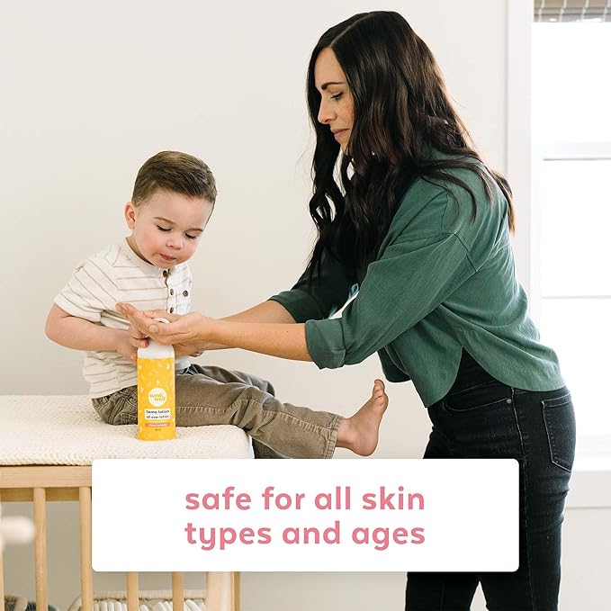 Wink Well Llama Baby Lotion for Kids- Gentle Baby Moisturizer for Calming Dry Skin-For Sensitive Skin Free of Parabens, Chemicals, Dyes and Fragrances- 14 Oz