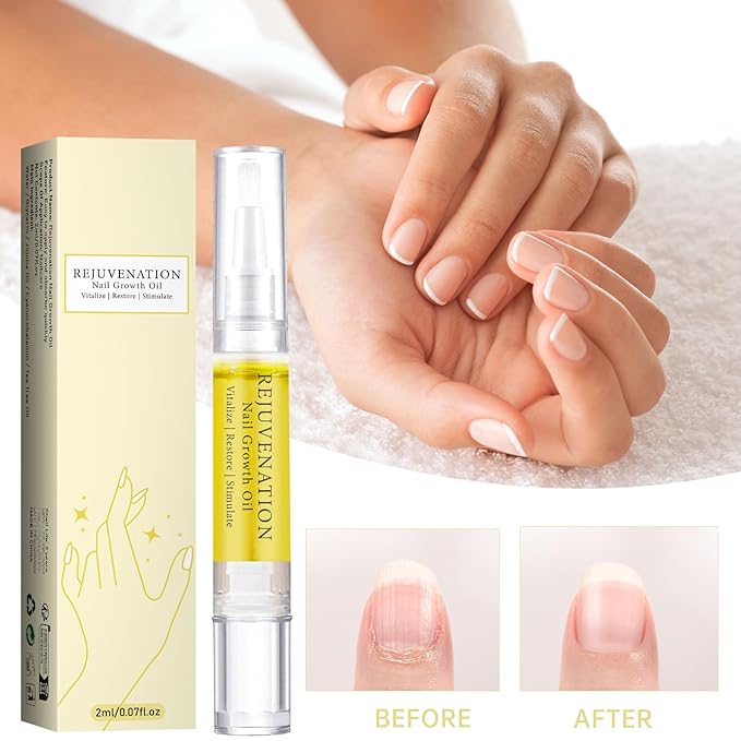 Nail Nutrition Oil Pen Nail Treatment Cuticle Revitalizer Oil Nail Growth Oil for Repairing and Strengthening Peeling and Broken Fine Nails