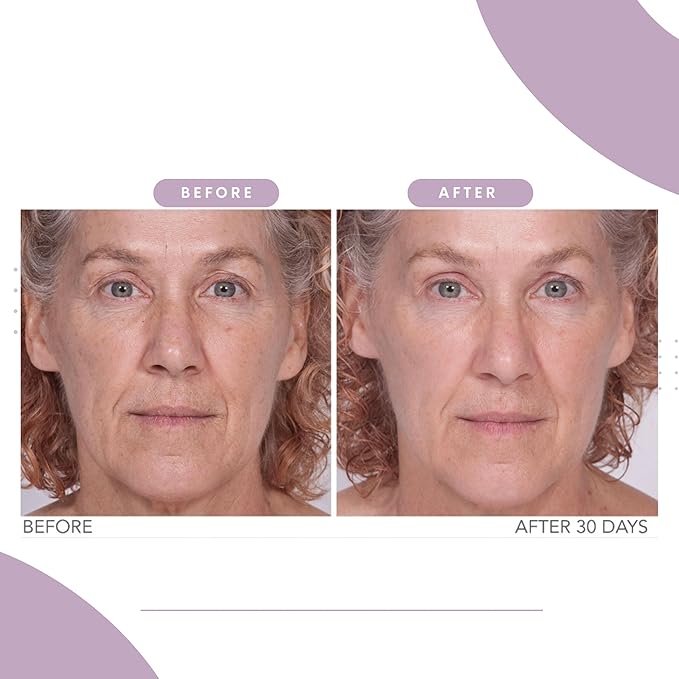 Serious Skincare Reverse Lift Trio Skin Firming Set - Tighten, Lift and Sculpt Face, Chin and Neck - Peptides - Hydrolyed Collagen - (3pack)