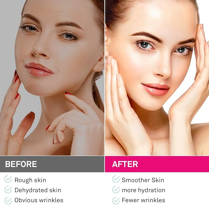 Facial and Forehead Wrinkle Patches: Face Wrinkle Treatment for Forehead, Smile Line, Under Eye- Anti Wrinkle Patches 192pcs