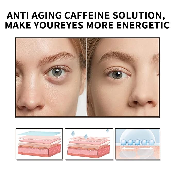 Caffeine Eye Serum With EGCG For Dark Circles and Puffiness, Anti Aging 5% Caffeine Solution For Puffy Eyes, Fine Lines, Moisturizing Under Eye Serum, 2PCS.