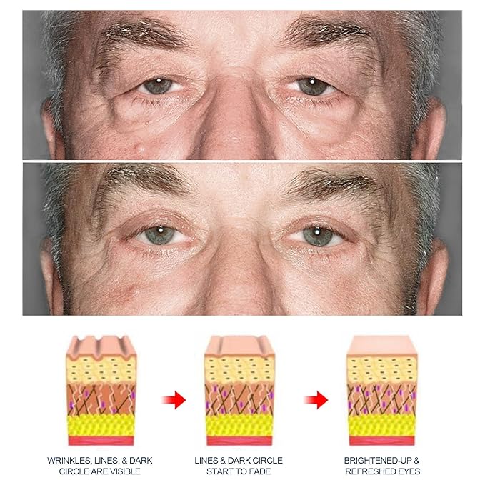 3PCS Awaken Peptide Depuffing Eye Gel, Peptide Lifting Eye Gel, Lifts Firming Anti-Wrinkle Eye Tightener, Natural Moisturizing Eye Cream for Reduces Puffiness/under Eye Bags/Dark Circles/Wrinkles