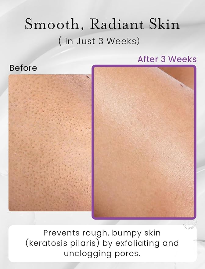 Elvira KP Bump Eraser Foot & Body Scrub, Exfoliating Scrub for Keratosis Pilaris, Smooth Skin with 10% AHA BHA & Niacinamide, Deep Moisturizing Cleanser for All Skin Types, Exfoliante para el Cuerpo