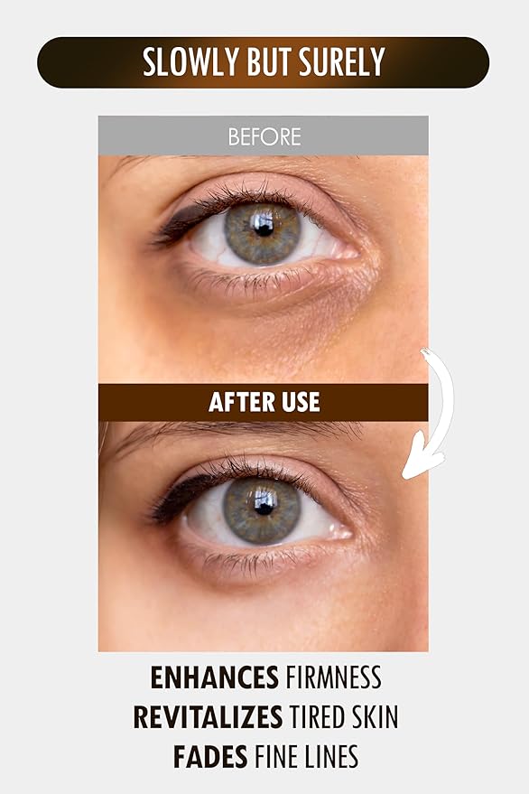 SUR.MEDIC+ 24K Gold Perfection All In One Cream for Face & Eye with Hyaluronic Acid, Panthenol and 24 Gold 1.18 oz